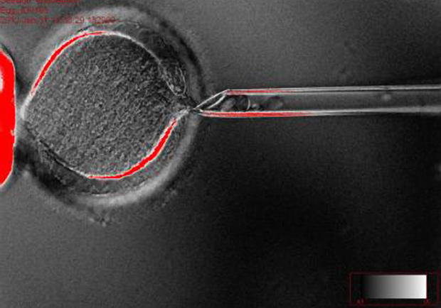 An image from the journal "Cell" shows the removal of genetic material from a human egg, the first step in creating embryonic stem cells from cloned embryos.