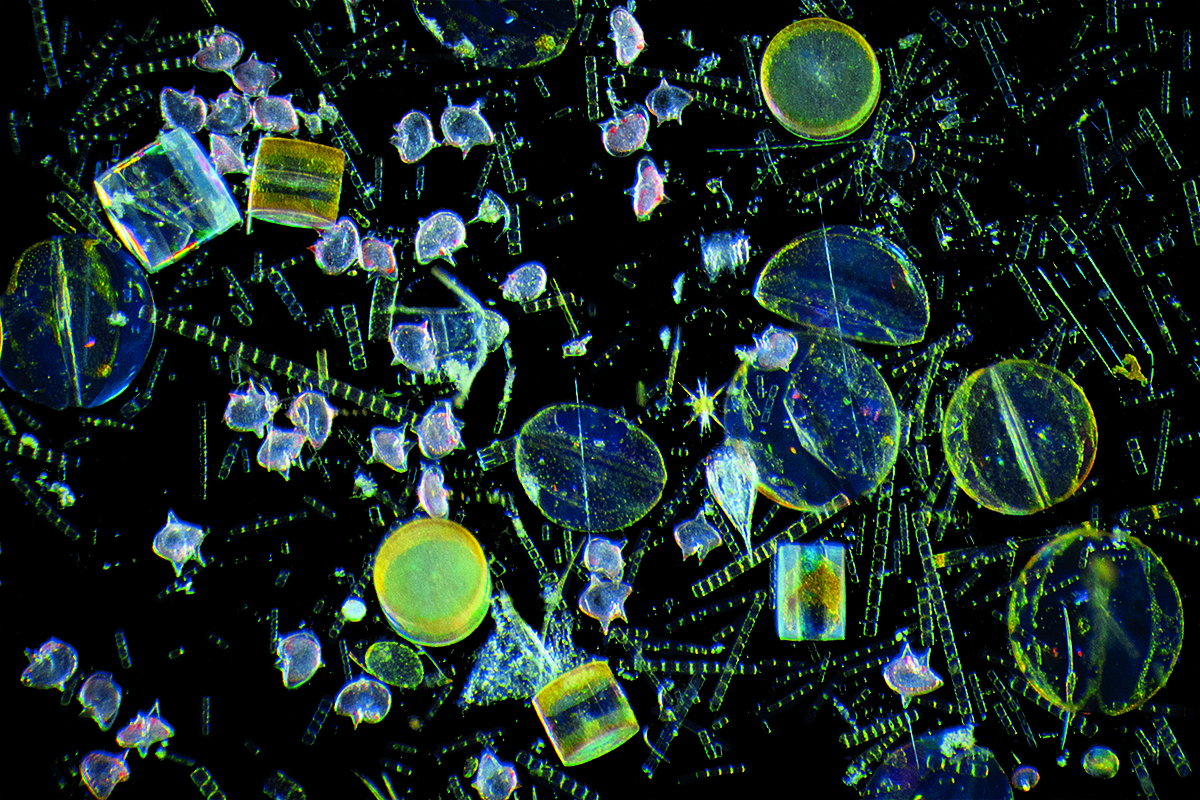 The large yellowish dome-like creatures are single-celled phytoplankton known as diatoms (specifically Coscinodiscus sp. and Hemidiscus sp.). Those long Tetris-like chains of Skeletonema sp. are diatoms as well. But the bright pink spiky creatures are Protoperidinium depressum— dinoflagellates that eat diatoms. At the center of this image, next to the yellow star-shaped radiolarian, is a barnacle larva.