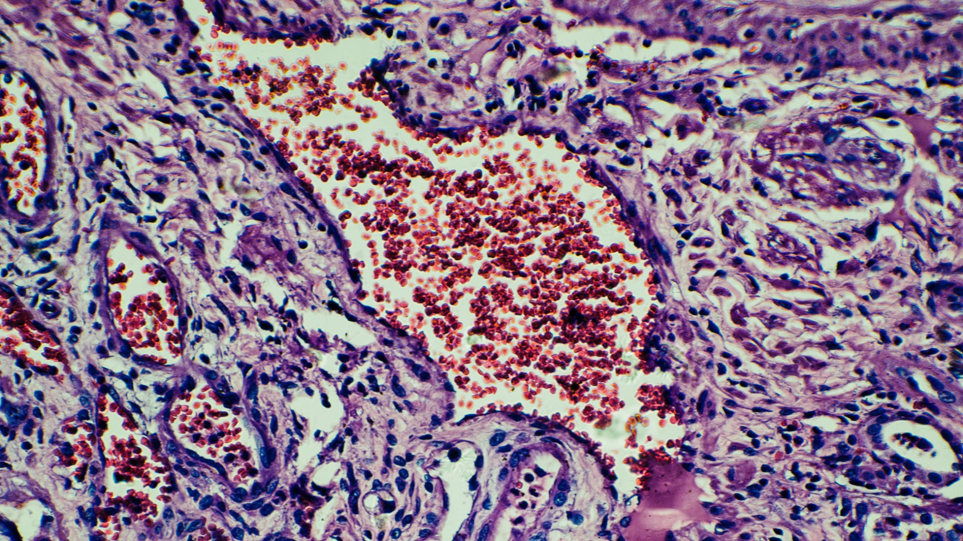 Kidney Micrograph
