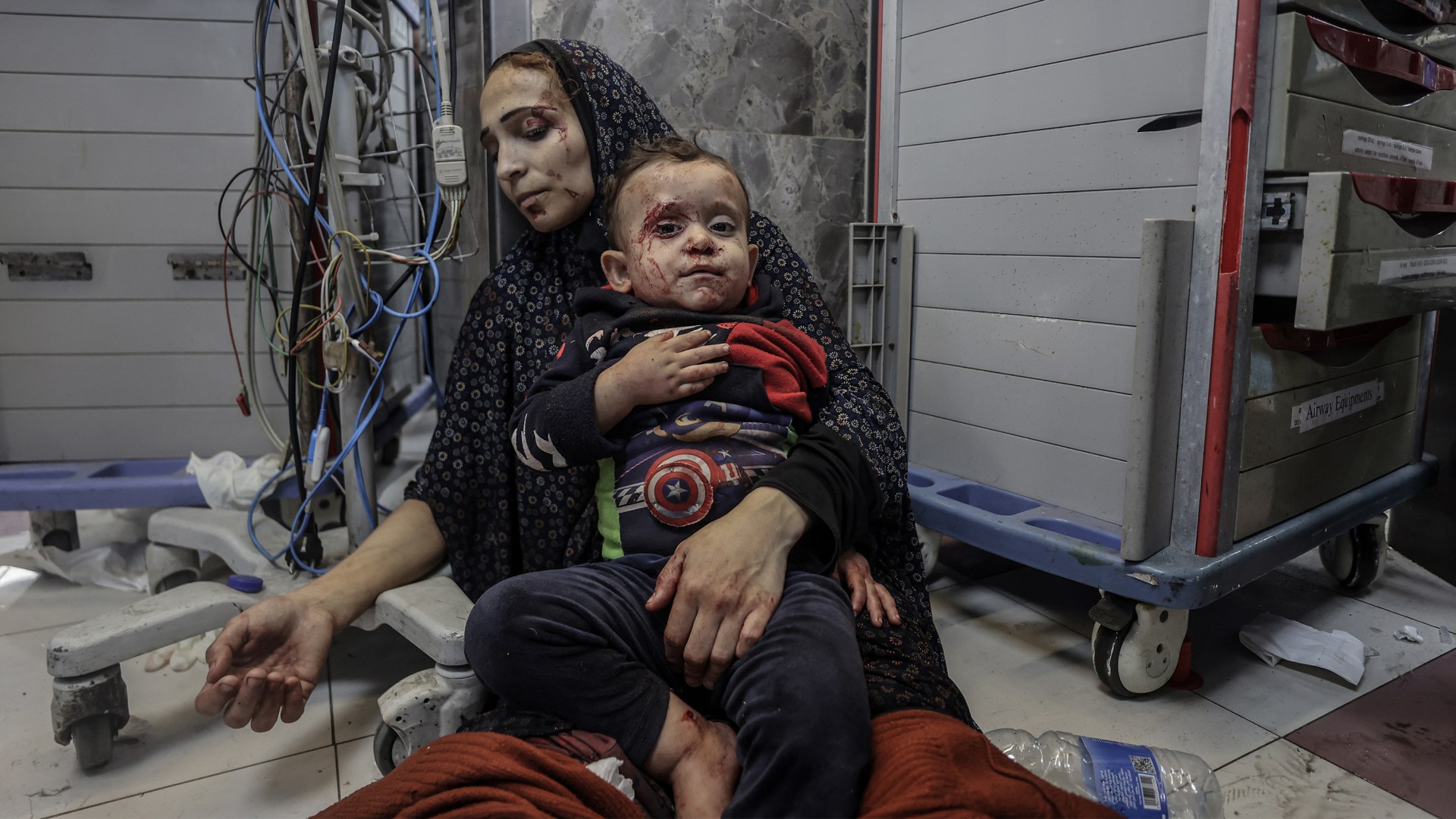 An injured mother and son taken to Al-Shifa Hospital following an explosion at Al-Ahli Hospital in Gaza.