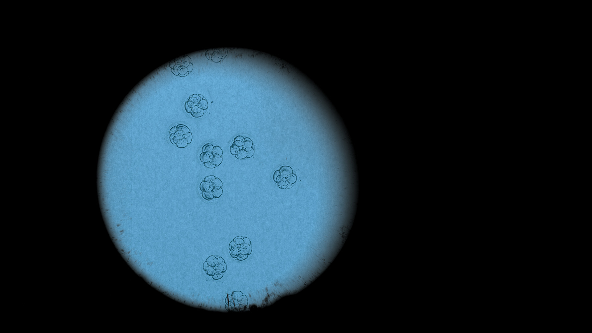 IVF embryos viewed under a microscope.