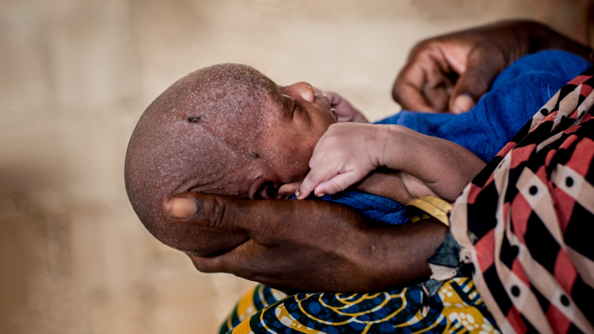 A mother holding her young baby at one of the nutrition clinics in Nigeria.