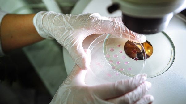 A Petri dish under a microscope.