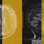 A collage of brain scans and an image of Jesus ascending to heaven.