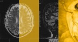 A collage of brain scans and an image of Jesus ascending to heaven.