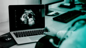 A doctor reviewing an ultrasound.